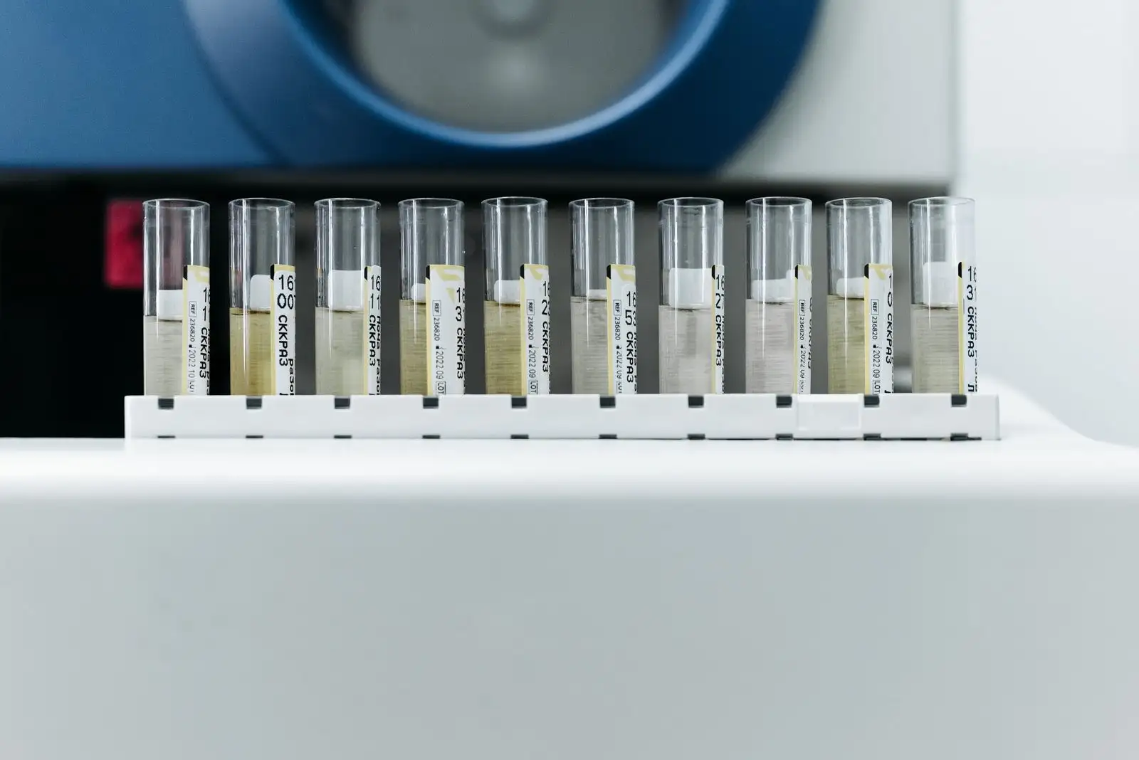 Fila de tubos de muestras de orina etiquetados delante de un analizador de laboratorio
