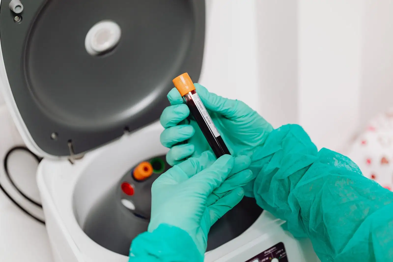 Manos con guantes colocando un tubo de sangre en una centrífuga de laboratorio antes de un análisis hepático