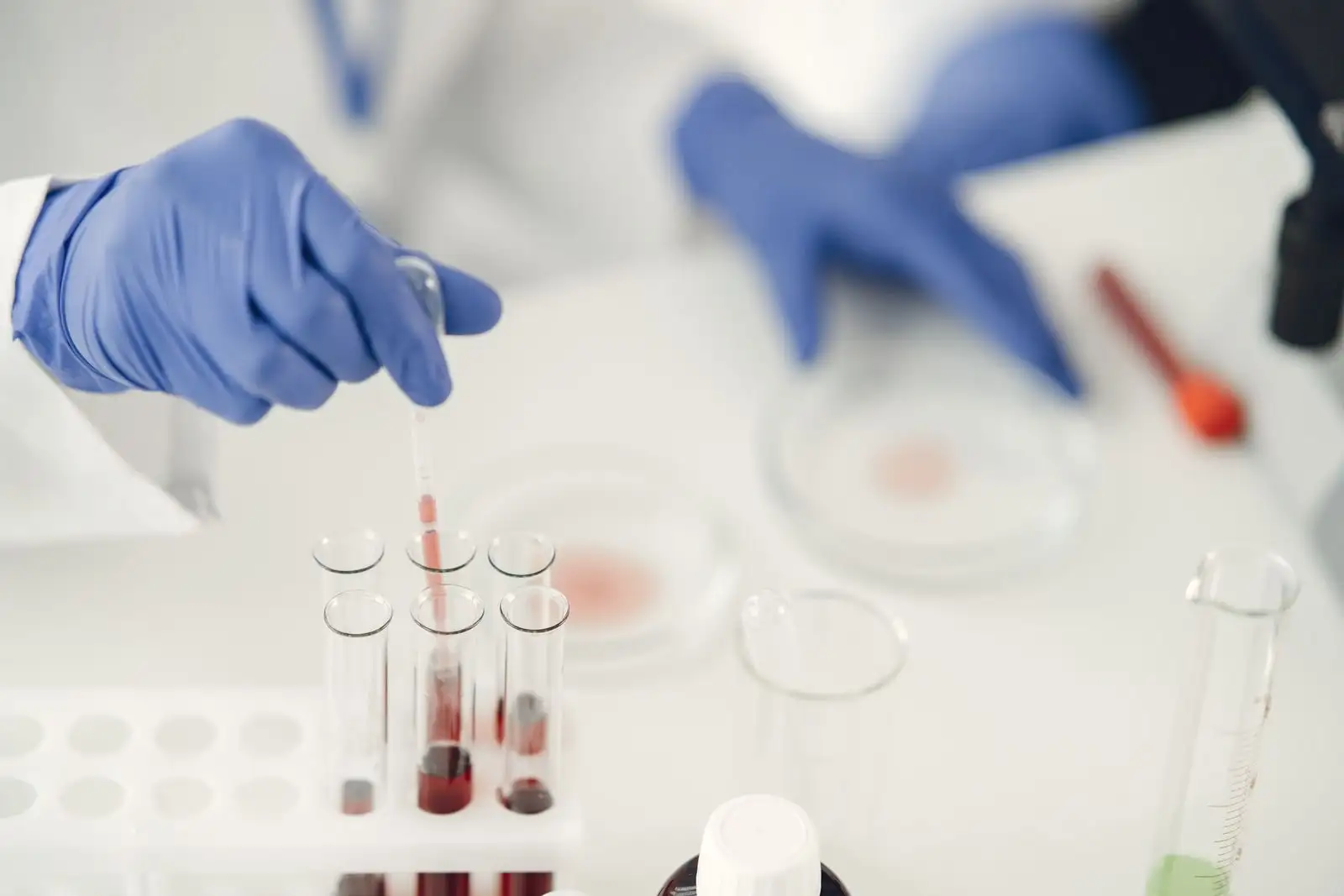 Manos con guantes tomando una muestra con pipeta sobre tubos de ensayo en un laboratorio