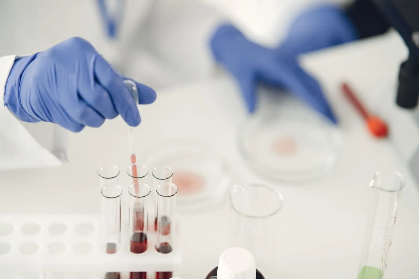Manos con guantes tomando una muestra con pipeta sobre tubos de ensayo en un laboratorio