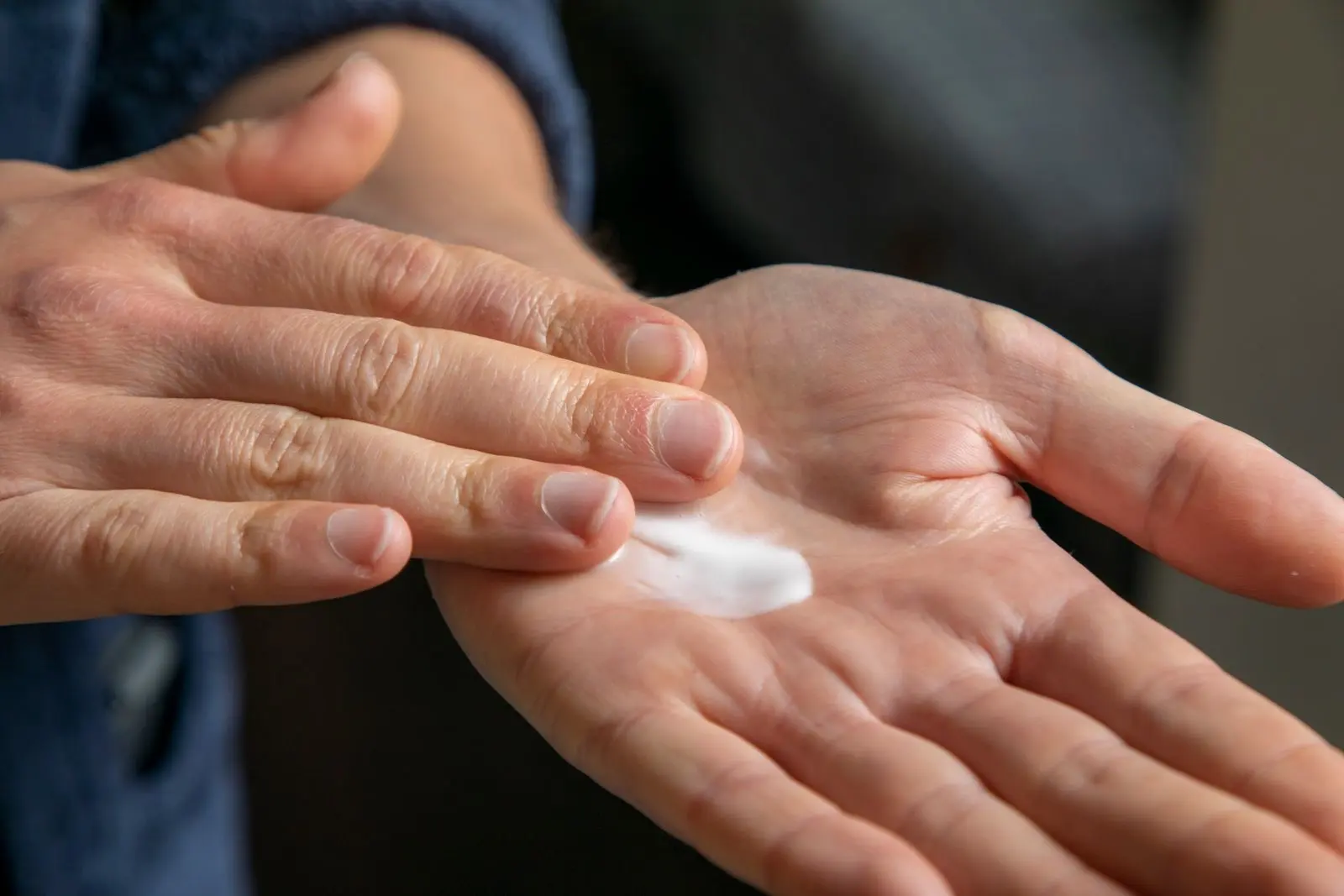 Un poco de crema blanca en la palma de una mano, lista para aplicarse